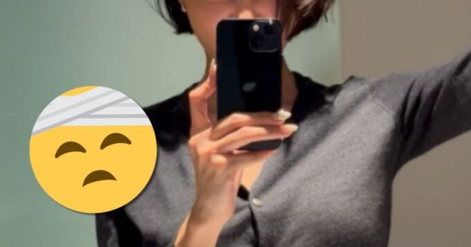 Idol Kesayangan Terlibat Kecelakaan Kebakaran Mengerikan Saat di Rumah Tanpa Pakaian