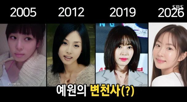 Kang Ye Won pasca operasi